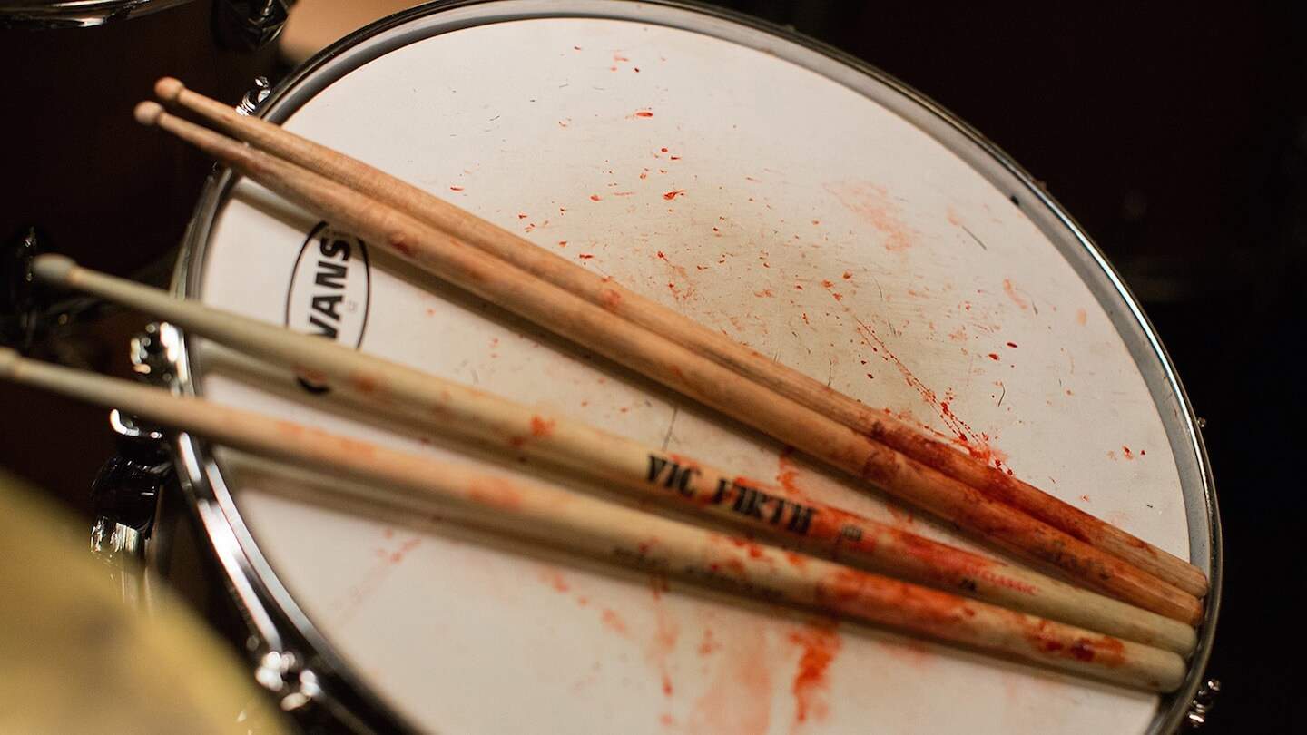 Whiplash – Winner Or Loser?